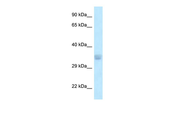 ACOT8 Rabbit Polyclonal Antibody
