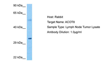 ACOT8 Rabbit Polyclonal Antibody