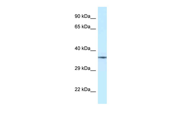 NUDT6 Rabbit Polyclonal Antibody
