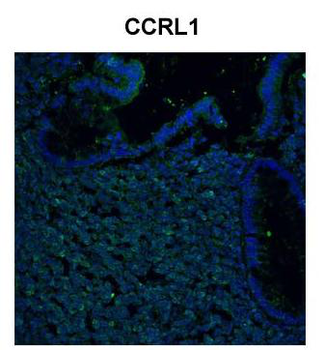 CCRL1 Rabbit Polyclonal Antibody