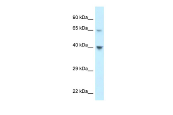 CCRL1 Rabbit Polyclonal Antibody