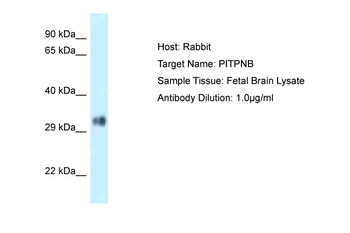 PITPNB Rabbit Polyclonal Antibody