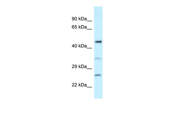 MED18 Rabbit Polyclonal Antibody