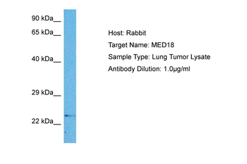 MED18 Rabbit Polyclonal Antibody