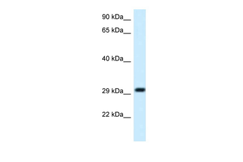 MRPL19 Rabbit Polyclonal Antibody