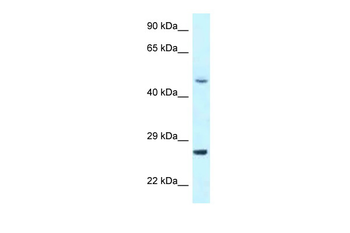 CDK20 Rabbit Polyclonal Antibody