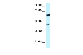 HOMER3 Rabbit Polyclonal Antibody