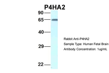P4HA2 Rabbit Polyclonal Antibody