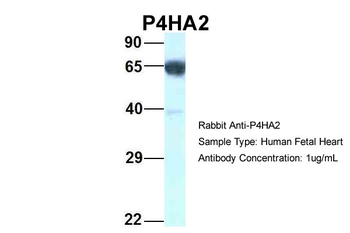 P4HA2 Rabbit Polyclonal Antibody