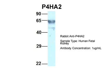 P4HA2 Rabbit Polyclonal Antibody