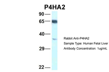 P4HA2 Rabbit Polyclonal Antibody