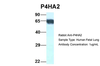 P4HA2 Rabbit Polyclonal Antibody