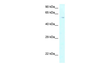P4HA2 Rabbit Polyclonal Antibody