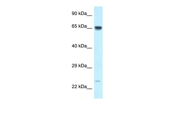 CTNNBL1 Rabbit Polyclonal Antibody