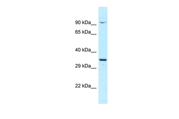 CTNNBL1 Rabbit Polyclonal Antibody