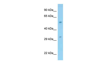 PPP1R16B Rabbit Polyclonal Antibody