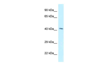 GPER Rabbit Polyclonal Antibody