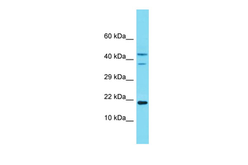 Ndufa8 Rabbit Polyclonal Antibody