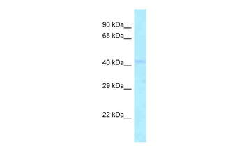 DPEP2 Rabbit Polyclonal Antibody