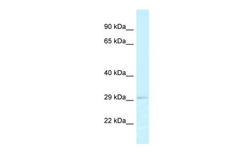 RPA2 Rabbit Polyclonal Antibody