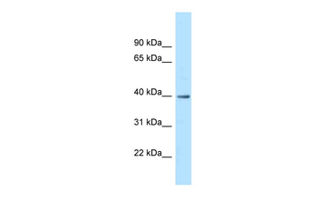 MRPS9 Rabbit Polyclonal Antibody