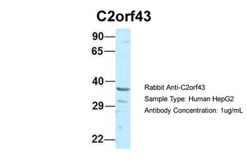 LDAH Rabbit Polyclonal Antibody
