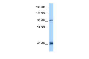 DACT1 Rabbit Polyclonal Antibody