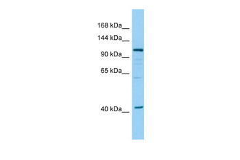 DHTKD1 Rabbit Polyclonal Antibody