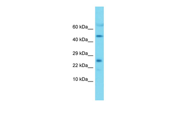 Mrpl22 Rabbit Polyclonal Antibody