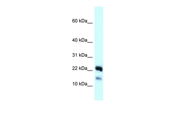 NDUFB10 Rabbit Polyclonal Antibody