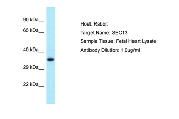 SEC13 Rabbit Polyclonal Antibody