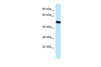 TARS2 Rabbit Polyclonal Antibody