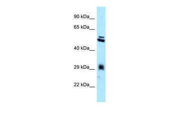 TMX1 Rabbit Polyclonal Antibody