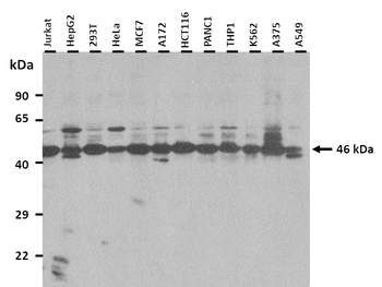 UBE2Q1 Rabbit Polyclonal Antibody