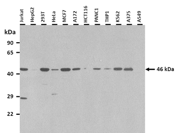 UBE2Q1 Rabbit Polyclonal Antibody