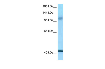 IARS2 Rabbit Polyclonal Antibody