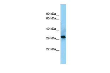 CD86 Rabbit Polyclonal Antibody