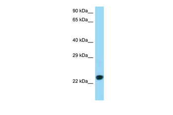 CD86 Rabbit Polyclonal Antibody