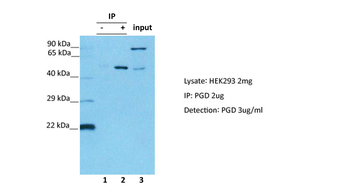 PGD Rabbit Polyclonal Antibody