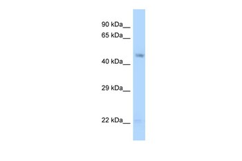 GDA Rabbit Polyclonal Antibody