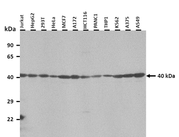 BMP4 Rabbit Polyclonal Antibody