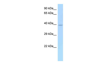 CD33 Rabbit Polyclonal Antibody