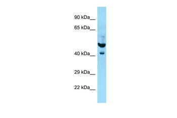PLAUR Rabbit Polyclonal Antibody