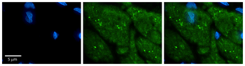 TFPI Rabbit Polyclonal Antibody