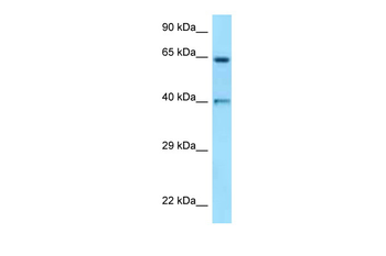 ANGPT1 Rabbit Polyclonal Antibody