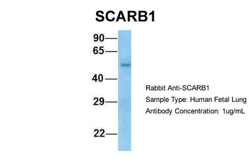 SCARB1 Rabbit Polyclonal Antibody