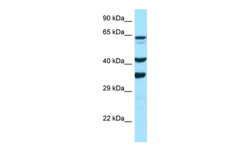 SPARC Rabbit Polyclonal Antibody