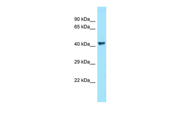 VEGFC Rabbit Polyclonal Antibody