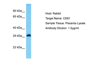 CD81 Rabbit Polyclonal Antibody