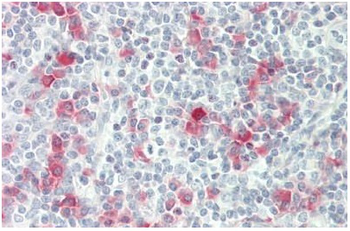 AICDA Rabbit Polyclonal Antibody